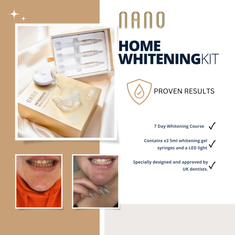 Nano Professional Teeth Whitening Kit Health Pillar Dubai